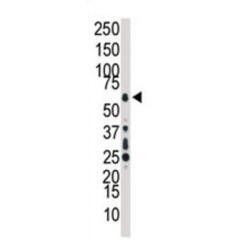 Mitogen-Activated Protein Kinase Kinase Kinase 7 (TAK1) Antibody