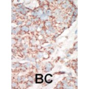 Serine/Threonine-Protein Kinase 25 (STK25) Antibody