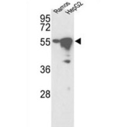 Serine/Threonine-Protein Kinase 25 (STK25) Antibody