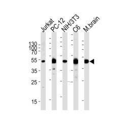 Dual Specificity Mitogen-Activated Protein Kinase Kinase 1 (MEK1) Antibody