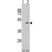 Dual Specificity Mitogen-Activated Protein Kinase Kinase 1 (MEK1) Antibody