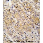 Mitogen-Activated Protein Kinase Kinase 2 (MAP2K2) Antibody