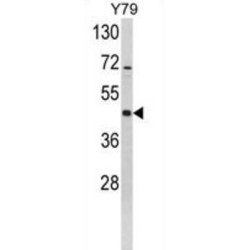 Mitogen-Activated Protein Kinase Kinase 2 (MAP2K2) Antibody
