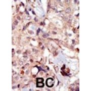 abx033796