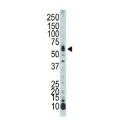 Serine/Threonine-Protein Kinase 39 (SPAK) Antibody