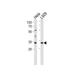 Caspase 9 (CASP9) Antibody