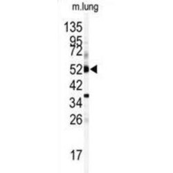 Cytochrome P450 1A1 (CYP1A1) Antibody