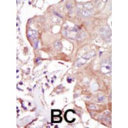GLK Antibody