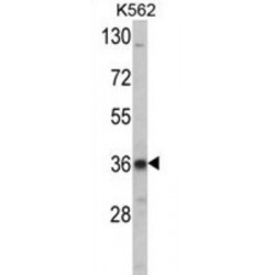 Low Density Lipoprotein Receptor Adapter Protein 1 (LDLRAP1) Antibody