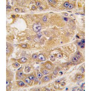 abx033819