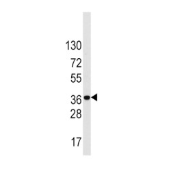 Low Density Lipoprotein Receptor Adapter Protein 1 (LDLRAP1) Antibody
