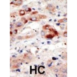 Phosphatidylinositol 3-Kinase Catalytic Subunit Type 3 (PI3KC3) Antibody