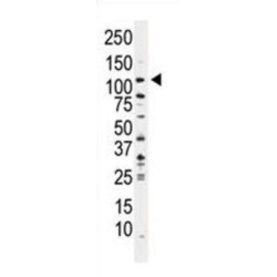Phosphatidylinositol 3-Kinase Catalytic Subunit Type 3 (PI3KC3) Antibody