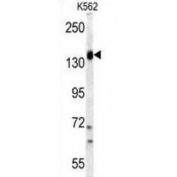 Phosphatidylinositol 4,5-Bisphosphate 3-Kinase Catalytic Subunit Gamma Isoform (PI3KCG) Antibody