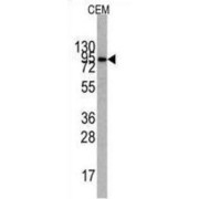 Phosphatidylinositol 3-Kinase Regulatory Subunit Alpha (PI3KR1) Antibody