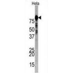 Phosphatidylinositol 3-Kinase Regulatory Subunit Alpha (PI3KR1) Antibody