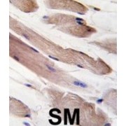 Phosphatidylinositol 3-Kinase Regulatory Subunit Alpha (PIK3R1) Antibody