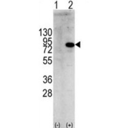 Phosphatidylinositol 3-Kinase Regulatory Subunit Alpha (PIK3R1) Antibody