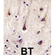 Phosphatidylinositol 3-Kinase Regulatory Subunit Beta (PIK3R2) Antibody