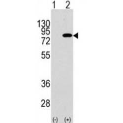 Phosphatidylinositol 3-Kinase Regulatory Subunit Beta (PIK3R2) Antibody