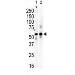 PI 4 Kinase type 2 beta Antibody