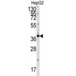 Endophilin B1 (SH3GLB1) Antibody