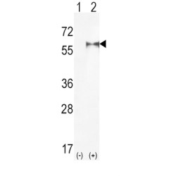 Phosphatidylinositol-4-Phosphate 5-Kinase Type 1 Alpha (PIP5K1A) Antibody