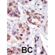 PIP5K2G Antibody