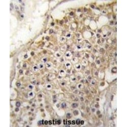 PIP5K2G Antibody