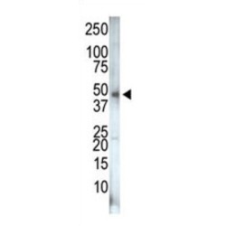 PIP5K2G Antibody