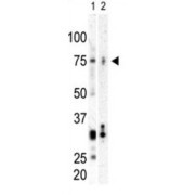 Serine/Threonine-Protein Kinase PLK3 (PLK3) Antibody