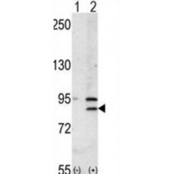 Bromodomain-Containing Protein 2 (BRD2) Antibody