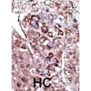 Diacylglycerol Kinase Zeta (DGKZ) Antibody