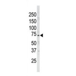 NUAK Family SNF1-Like Kinase 1 (ARK5) Antibody