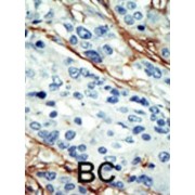 NUAK Family SNF1-Like Kinase 1 (ARK5) Antibody