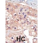 Kinase Interacting With Stathmin (KIST) Antibody