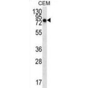 NIMA Related Kinase 3 (NEK3) Antibody