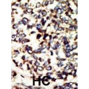 Serine/Threonine-Protein Kinase Nek7 (NEK7) Antibody
