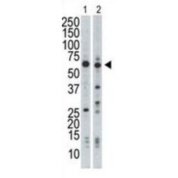 Nuclear Receptor-Binding Protein (NRBP) Antibody