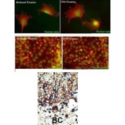Protein Kinase C And Casein Kinase Substrate In Neurons Protein 2 (PACSIN2) Antibody