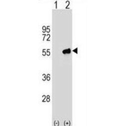 Protein Kinase C And Casein Kinase Substrate In Neurons Protein 3 (PACSIN3) Antibody