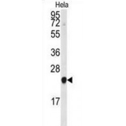 Platelet Basic Protein (PBP) Antibody