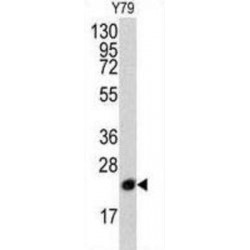 Platelet Basic Protein (PBP) Antibody