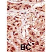 p53-Related Protein Kinase (PRPK) Antibody