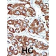 Serine/threonine-Protein Kinase SNF1-Like Kinase 1 (SNF1LK) Antibody