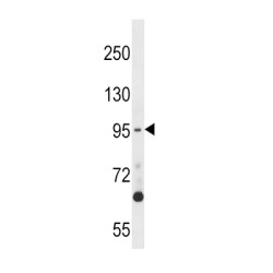 Dual Specificity Protein Kinase TTK (TTK) Antibody