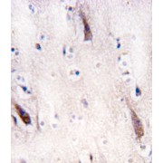 Unc-51 Like Autophagy Activating Kinase 2 (ULK2) Antibody