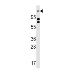Unc-51 Like Autophagy Activating Kinase 2 (ULK2) Antibody