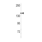 Unc-51 Like Autophagy Activating Kinase 2 (ULK2) Antibody