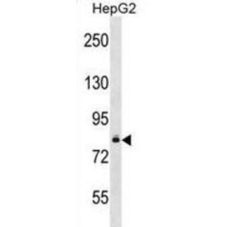 Diacylglycerol Kinase Beta (DGKB) Antibody